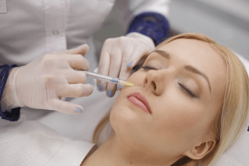 Коррекция носогубных складок филлерами