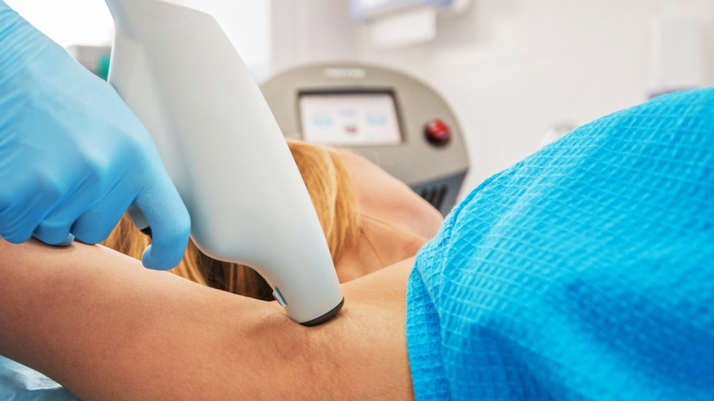 Лечение гипергидроза