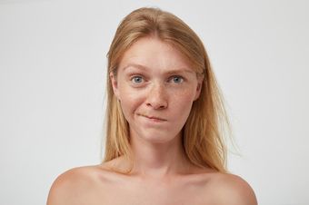 Удаление пигментных пятен