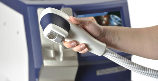 лазерная эпиляция верхней губы.jpg